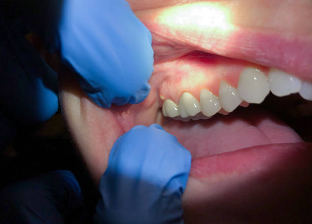 Best Orthodontic Emergency Dentist in Forest Hills, MI